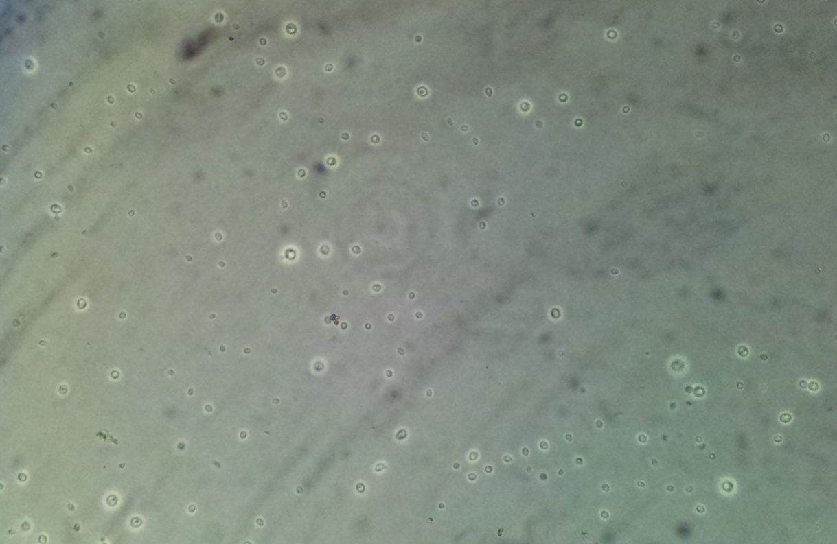 sachin Kale, pathology, Cryptococcus, India Ink